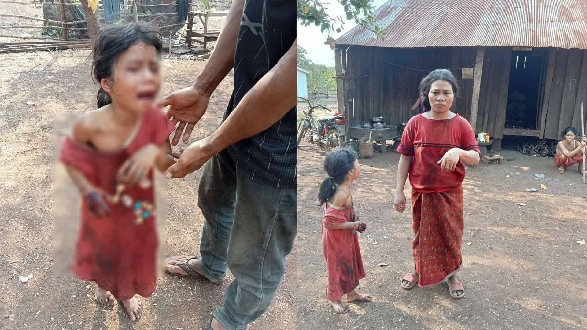 ជនរងគ្រោះ