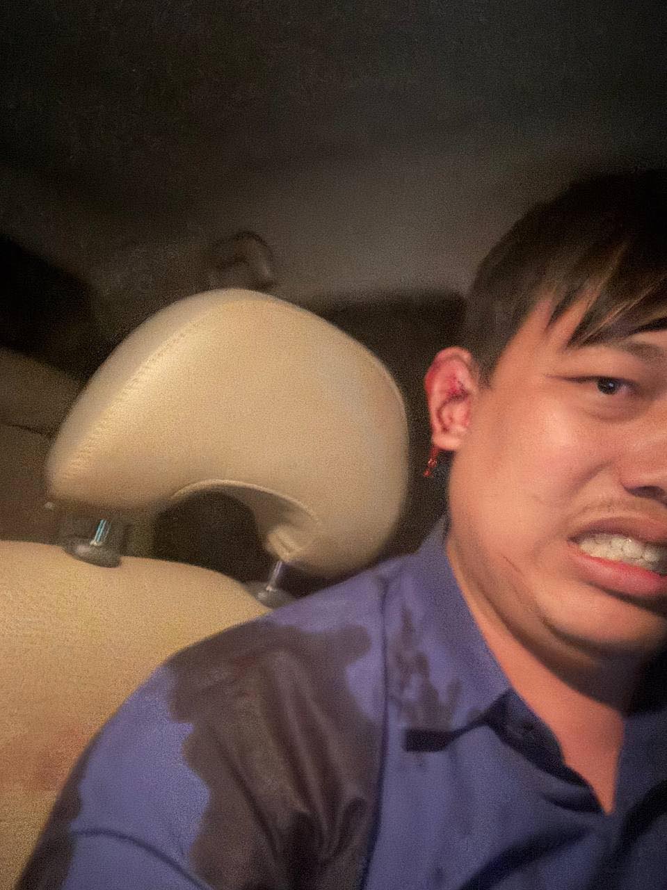 ជនរងគ្រោះ